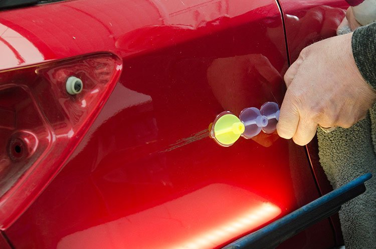 dent removal
